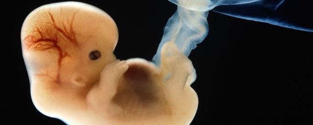 Ученые научились определять патологии мозга у эмбриона внутри утробы