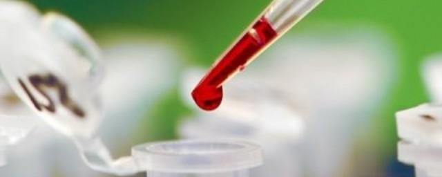 Ученые: Диагностировать шизофрению можно по анализу крови