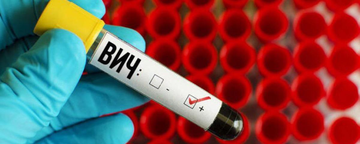 В России обяжут лечить больных ВИЧ, не имеющих постоянной прописки