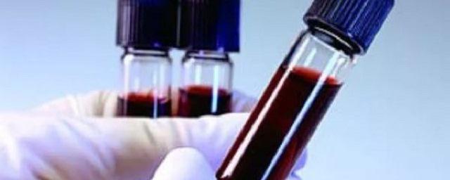 Оперативный способ определения группы крови разработали в КНР