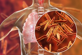 Иркутские ученые изучают микробов в  туберкулезных очагах в легком, чтобы эффективно бороться с болезнью