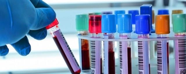 Ученые изобрели новый вид анализа крови, определяющий рак