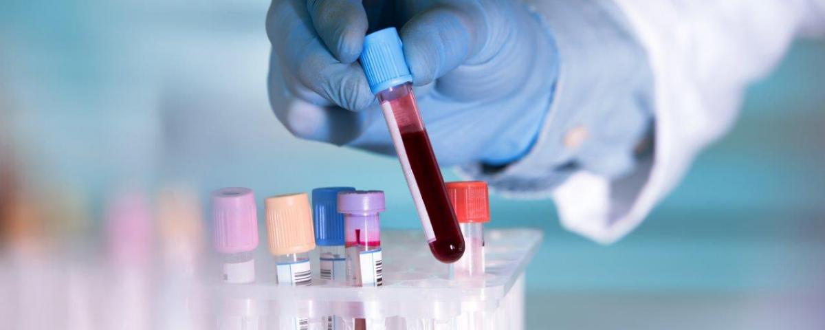 Ученые: новый анализ крови поможет диагностировать рак почек
