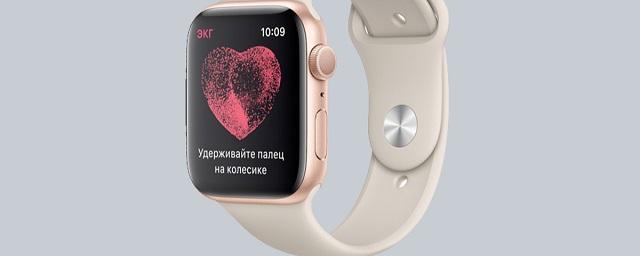 Apple разблокировала функцию «ЭКГ» на Apple Watch для пользователей из России