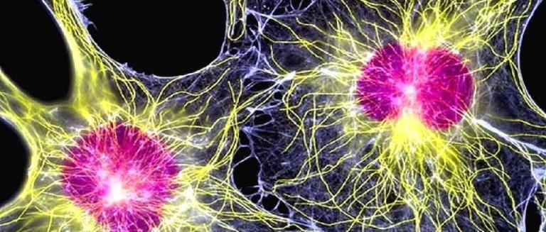 Ученые: Стволовые клетки могут восстановить мозг после инсульта