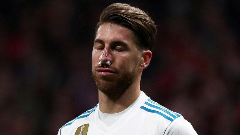Капитан «Реала» Серхио Рамос получил перелом носа в матче с «Атлетико»