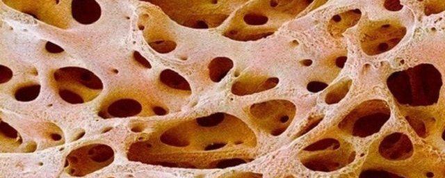 Британские ученые впервые вырастили костную ткань в чашке Петри