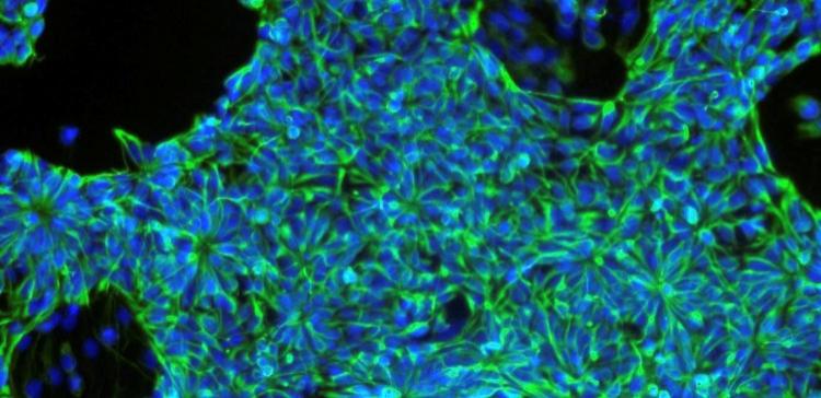 Ученые: Пересадка стволовых клеток может спровоцировать рак