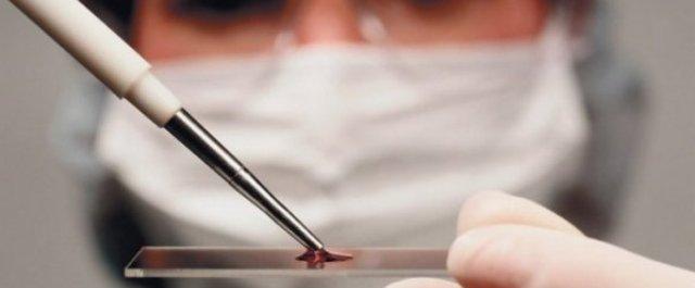 Генетики из Австралии создали искусственные клетки крови