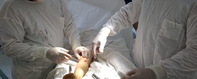 В Черкесске проведена уникальная операция ребенку