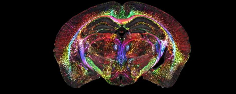 Ученые из США получили самые подробные МРТ-снимки мозга за всю историю