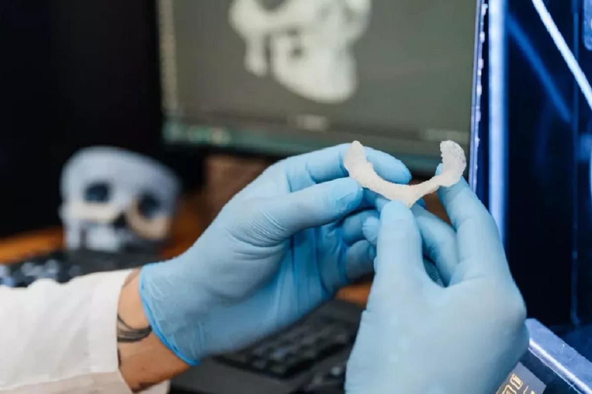 Томские ученые разработали импланты для костной ткани