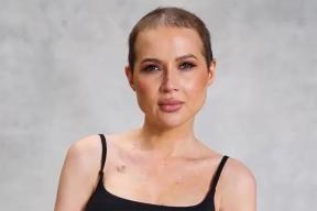 Шрамы вместо парика и запрет суда: Лерчек показала тело в белье, а фанаты разделились