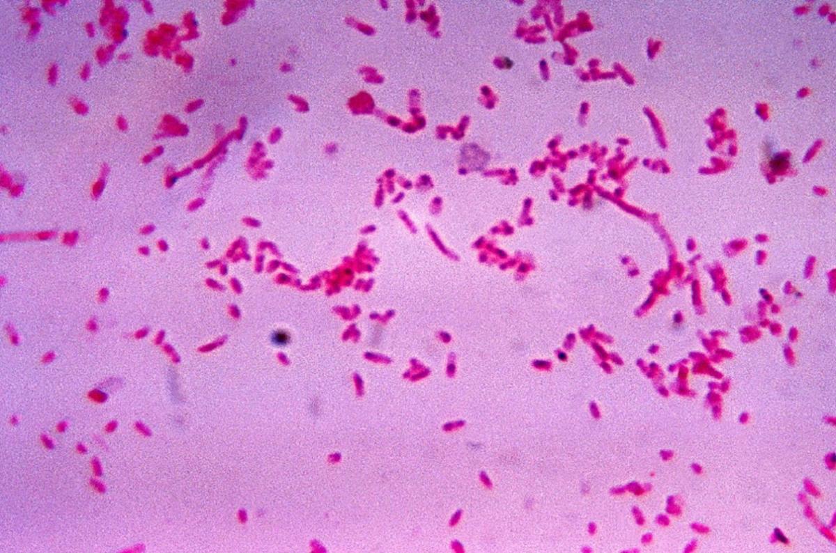 Фузобактерии во рту «растворяют» 70-99% клеток некоторых видов рака шеи и головы