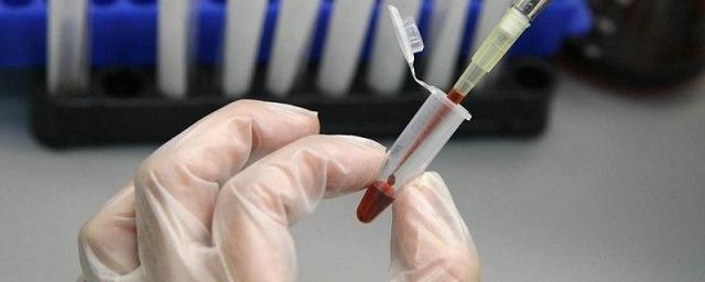 Роспотребнадзор: В США более 1000 человек заразились гепатитом А