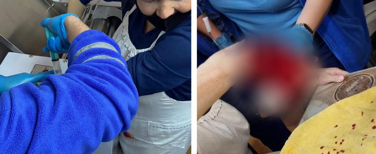 В Новосибирске женщина попала рукой в тестораскаточную машину