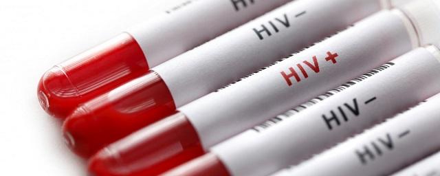 В России назвали регионы с самой высокой смертностью от ВИЧ