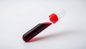 Обнаружена новая группа крови: женщина, которая может быть донором только для себя