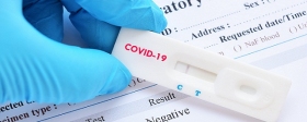 Russia has developed a rapid test to detect Covid-19 in saliva