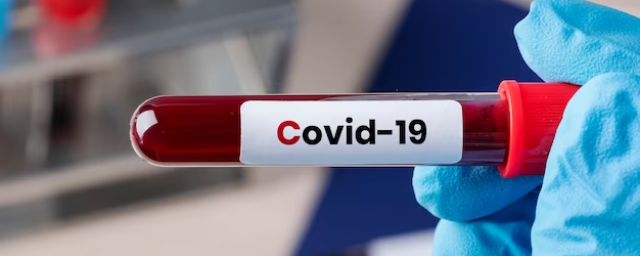 В России подтвердили уже 17 случаев заражения новым штаммом коронавируса Eris