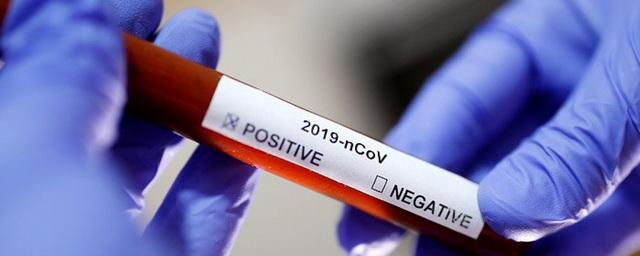В России за сутки коронавирусом заразились сразу 500 человек