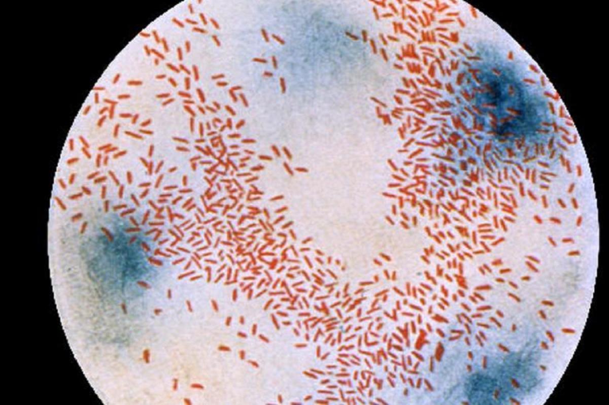Респираторные бактерии освоили «управление» иммунитетом человека