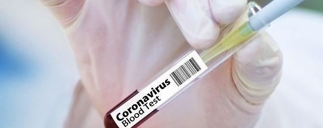 Belarus breaks record for number of coronavirus infections