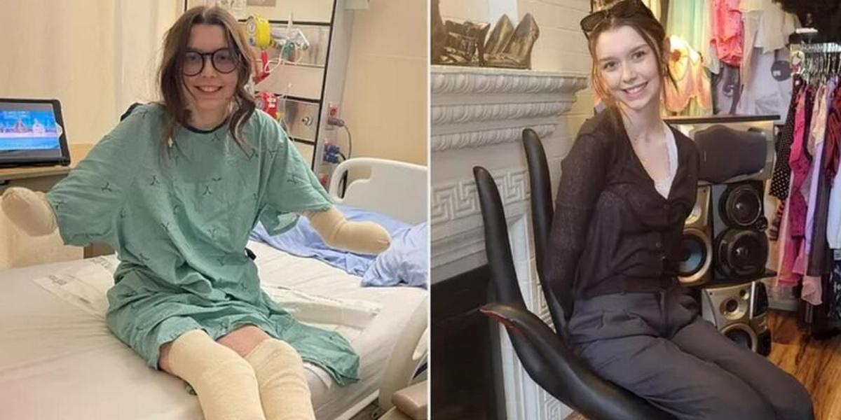 Юная жительница США списала недомогание на запор и лишилась рук и ног