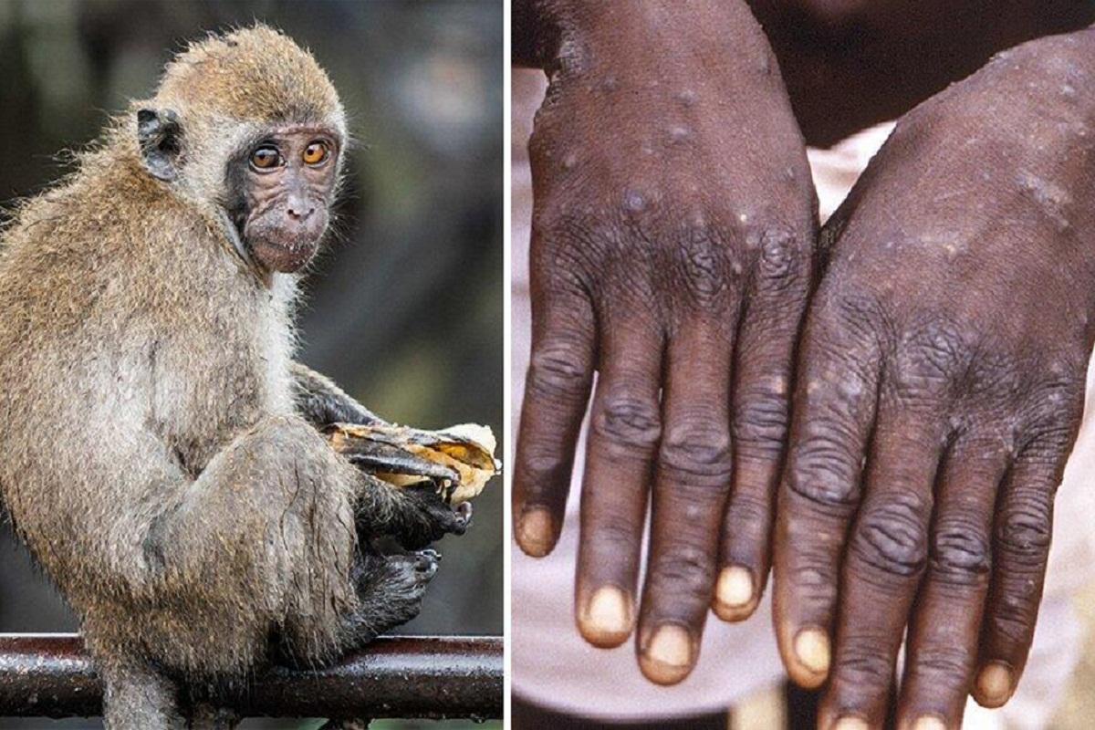 Еще три человека заразились в Камбодже вирусом оспы обезьян
