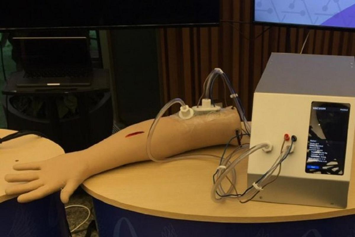 Российские ученые представили устройство для вакуумного лечения ран