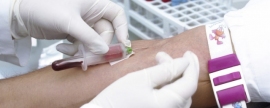 В Барнауле мужчины могут 24 июня бесплатно сдать биохимический анализ крови