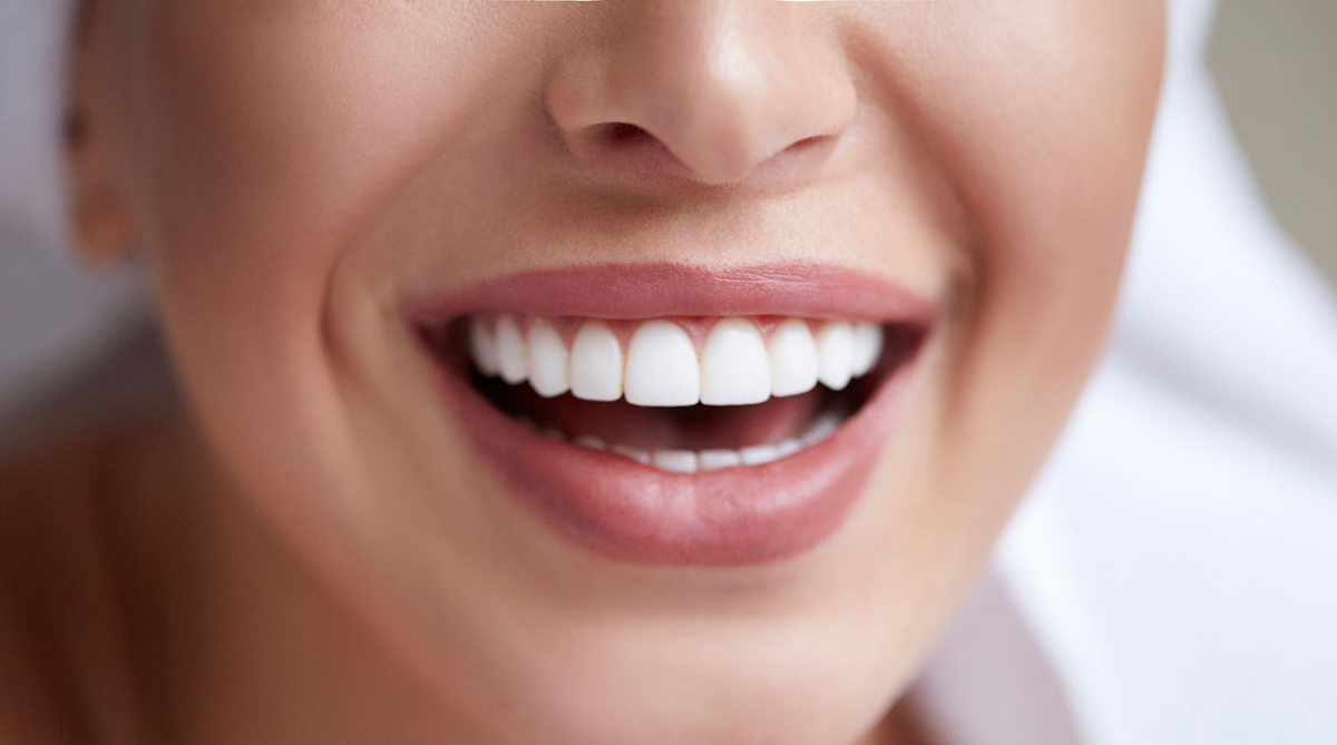 Стоматолог назвала самые опасные народные методы отбеливания зубов