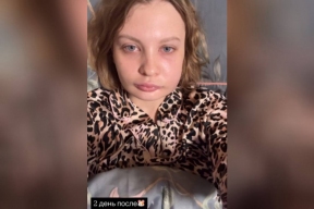 «Опухла еще больше»: как выглядит невестка Наташи Королевой после второй операции на челюсти