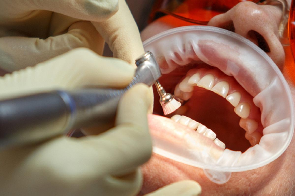 Биологи из университета Плимута придумали, как заставить зубы расти заново