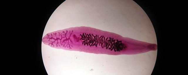 В Оби выявлен червь, способный вызвать онкологию у человека