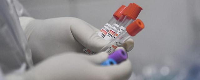 В Свердловской области выявили три новых случая коронавируса