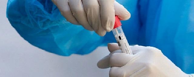 Еще 87 человек заболели коронавирусом на Кубани