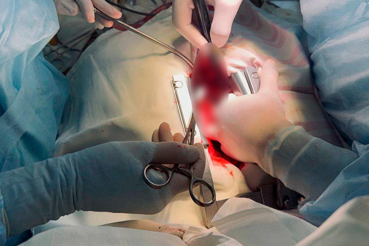 Новая хирургическая практика внедрена в Егорьевской больнице