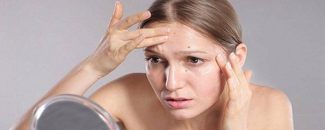 Косметолог Савина: Хронический стресс может вызвать рак кожи