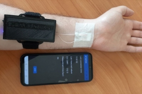 Российские ученые разработали биосенсоры для определения глюкозы по поту