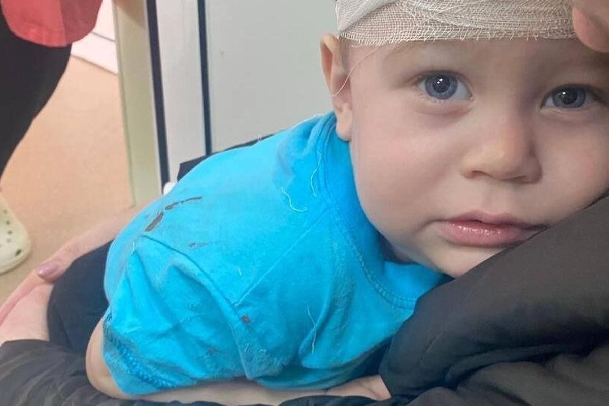 В Тюмени отец двухлетнего ребенка подаст в суд на детсад, где сын получил травму