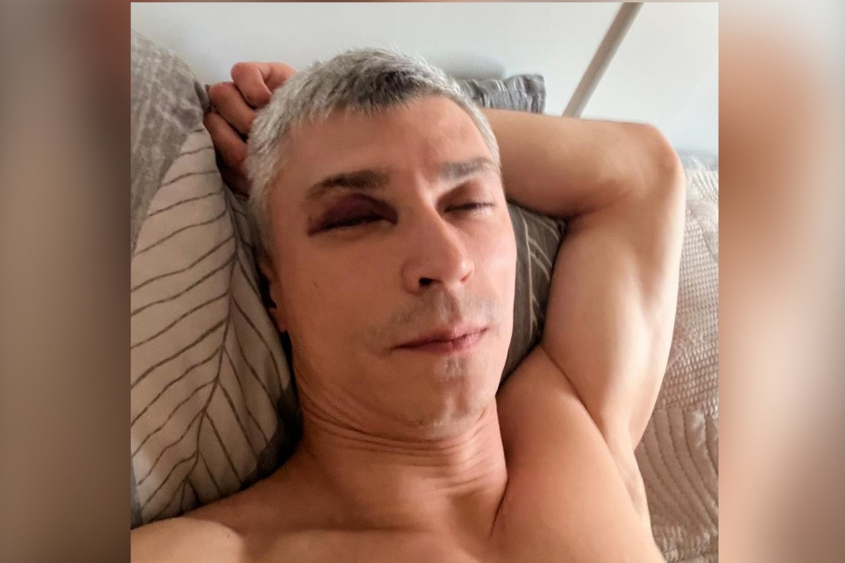 В Твери после избиения паралимпийца возбуждено дело о хулиганстве