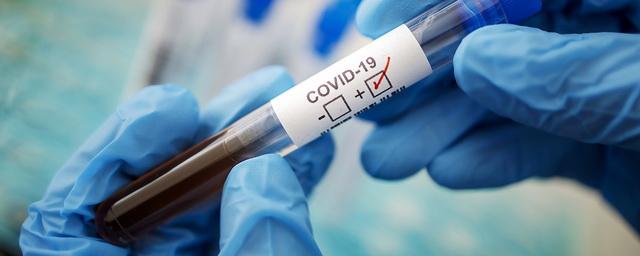 В Новосибирской области подтверждены еще 107 случаев коронавируса