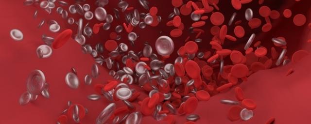 Ксантомы на лице могут свидетельствовать о высоком уровне холестерина в крови