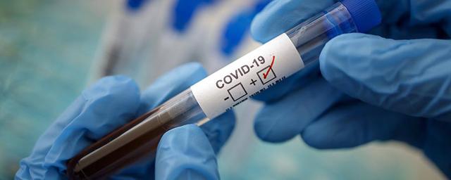 В Ивановской области еще 181 житель заразился коронавирусной инфекцией