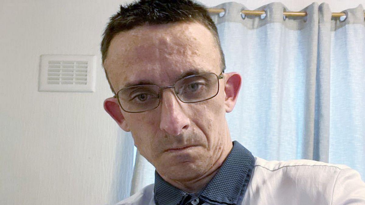 Мужчина вырос более чем на фут после операции по удалению опухоли головного мозга