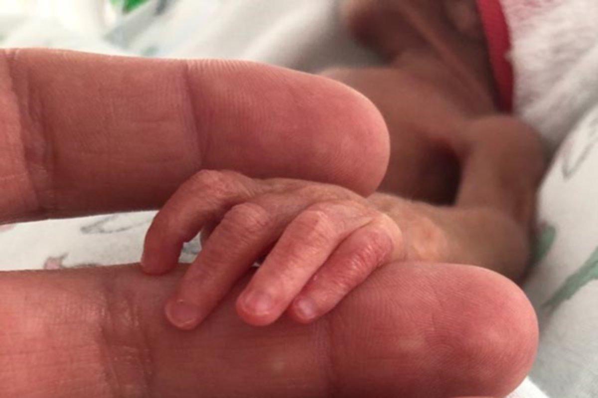 В рязанском перинатальном центре спасли малышку, весившую при рождении 450 граммов