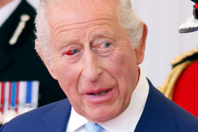 Лопнувший сосуд или тревожный симптом? Что случилось с глазом британского монарха