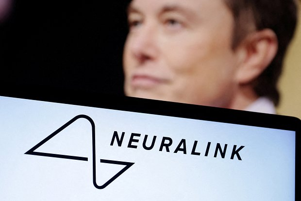 Neuralink начала отбор желающих вживить себе чип в мозг