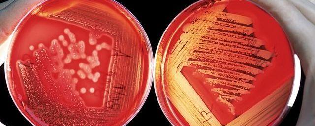 Пермские ученые нашли более эффективное средство от стафилококка